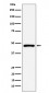 Anti-PSMC5 Rabbit Monoclonal Antibody